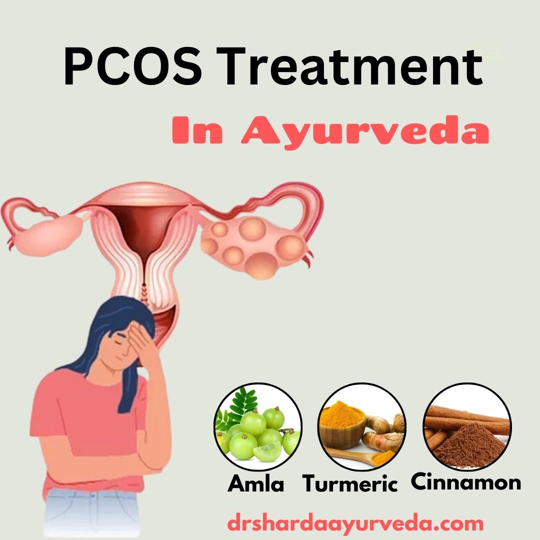 Ayurvedic Treatment For Pcod Pcos 17315845329