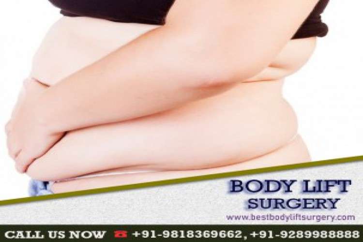 Best Body Lift Surgery India 6520395