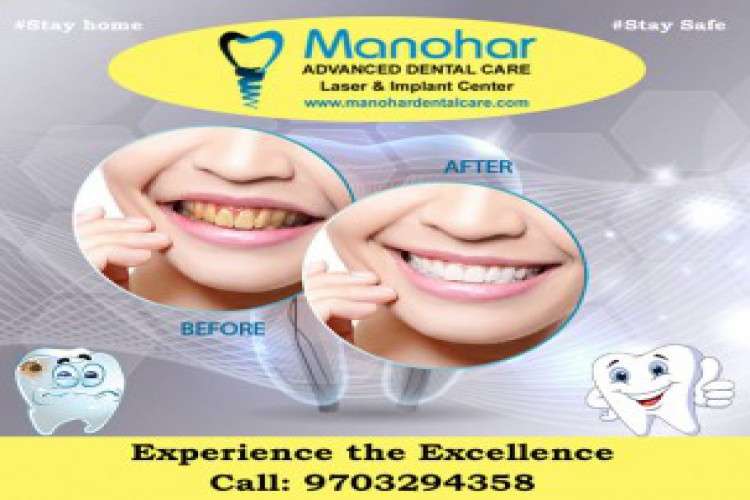 Best Dental Fluoride Clinic In Vizag 1814329