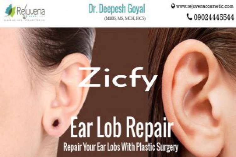 Best Earlobe Repair In Jaipur 9599487