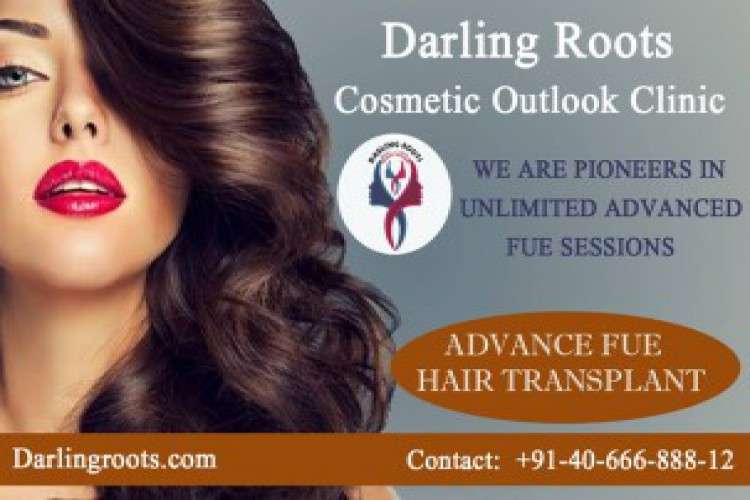 Best Fue Hair Transplant Clinic In Hyderabad Darling Roots 3034566