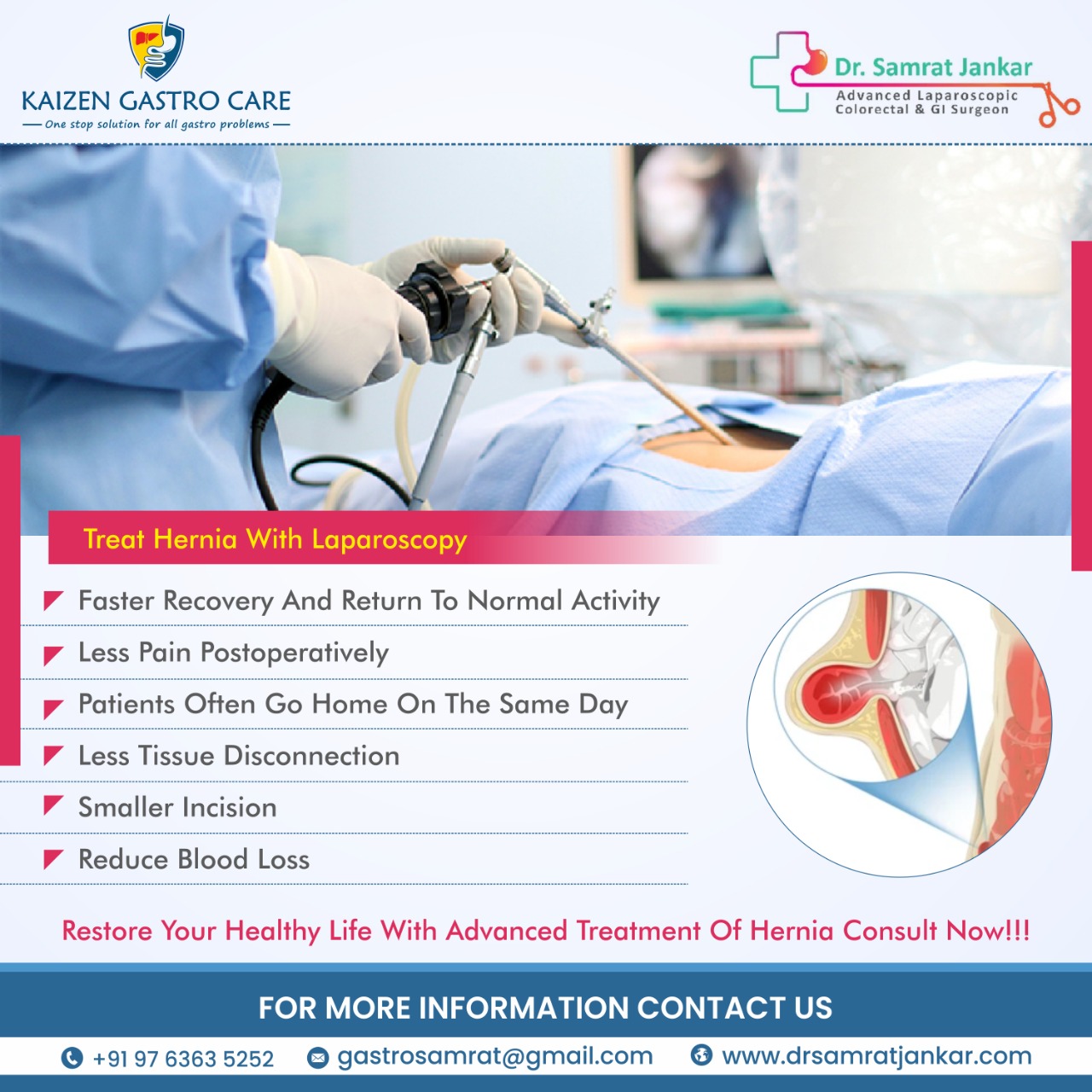 Best Gastroenterologist In Pcmc Pune Dr Samrat Jankar 16703301656