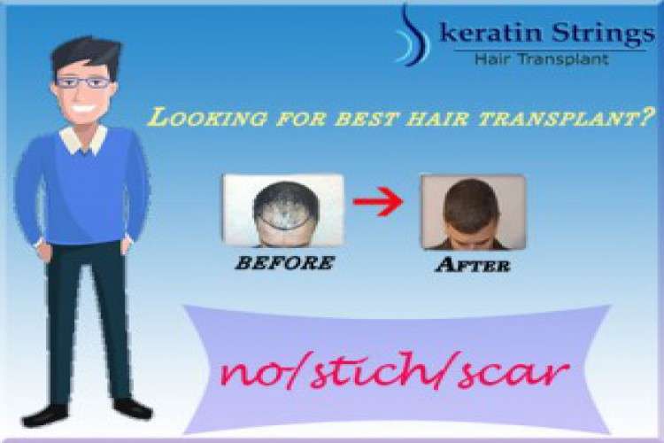 Best Hair Transplant Clinic In Noida   Keratin 4225276