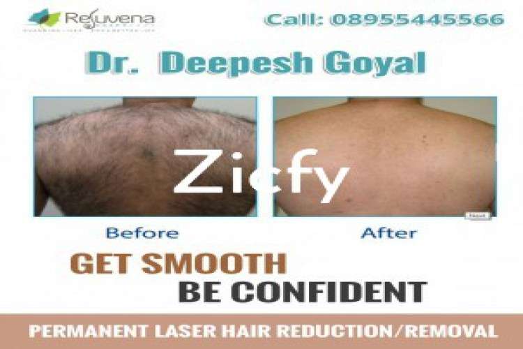 Best Laser Hair Removal Treatment In Jaipur 1356003