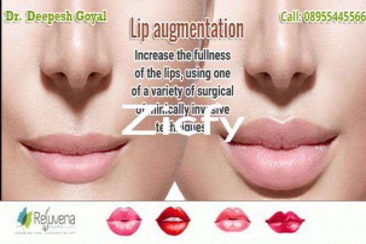 Best Lip Surgery In Jaipur By Dr Deepesh Goyal 1937554