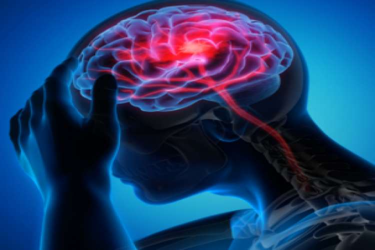 Best Neurologist In Indore Dr Navin Tiwari 220306