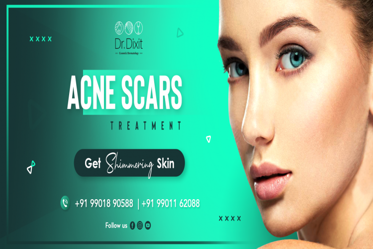 Best Skin Specialist In Koramangala 16406006349