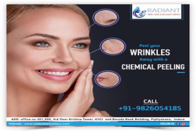 Chemical Peeling Treatment In Indore 8881599