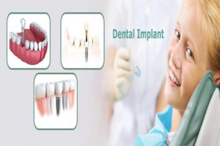 Dr Alkesh V Shah Dental Implant In Ahmedabad 6729978