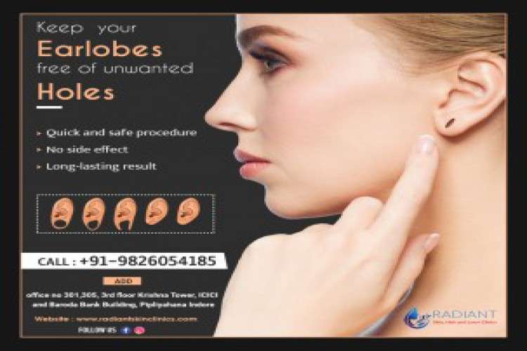 Ear Lobe Repairing Treatment In Indore 5769238