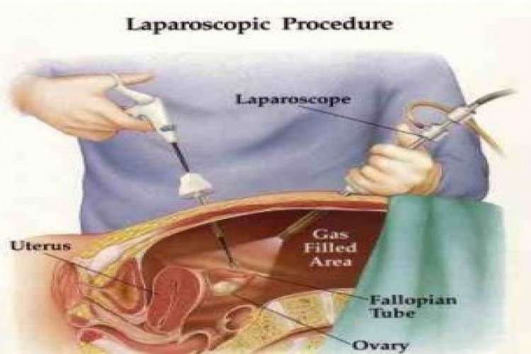 Expert Laparoscpic Surgeon In Ahmedabad 1543129