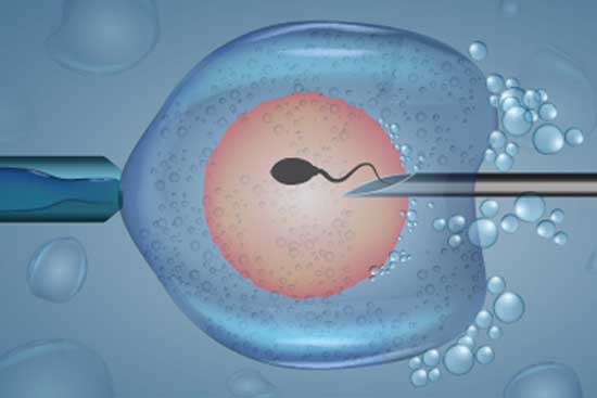 Exploring Ivf Options In India Starting A Family 17074186974