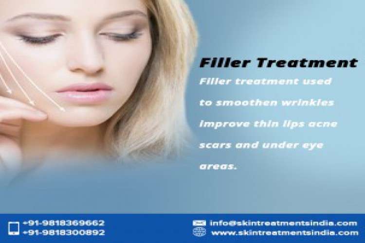 Facial Filler Treatment In South West Delhi 124740