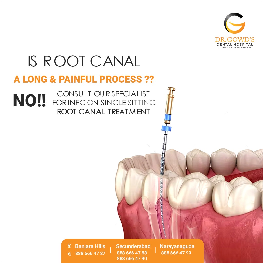 Full Mouth Implants Cost In Hyderabad 16800136243