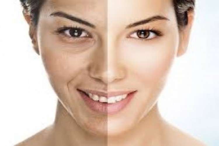 Get Desire Look With A Cosmetic Surgery 748456