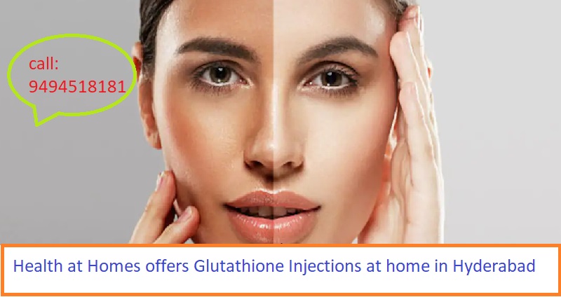 Glutathione Injections At Home In Hyderabad 16868943316