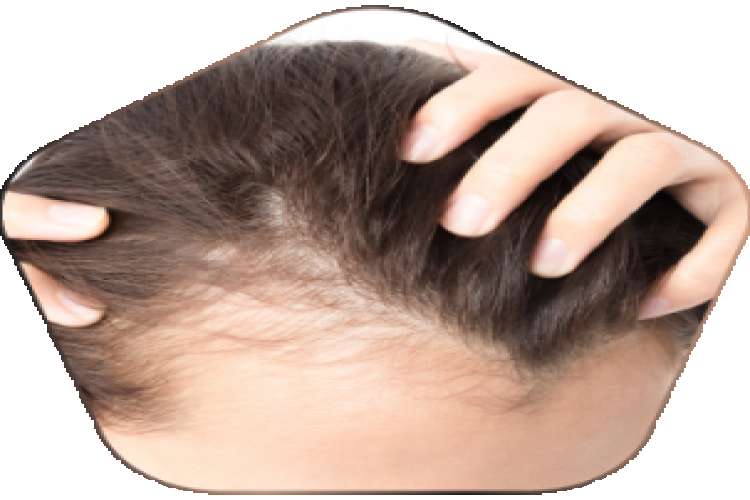 Hair Loss Treatment In Hyderabad 2672094