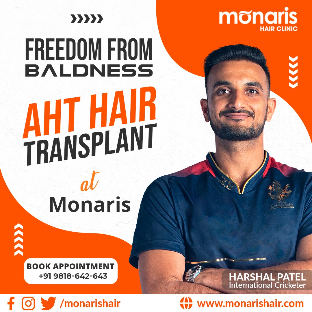 Hair Replacement In Delhi And Hair Transplant At Monaris 16667648646