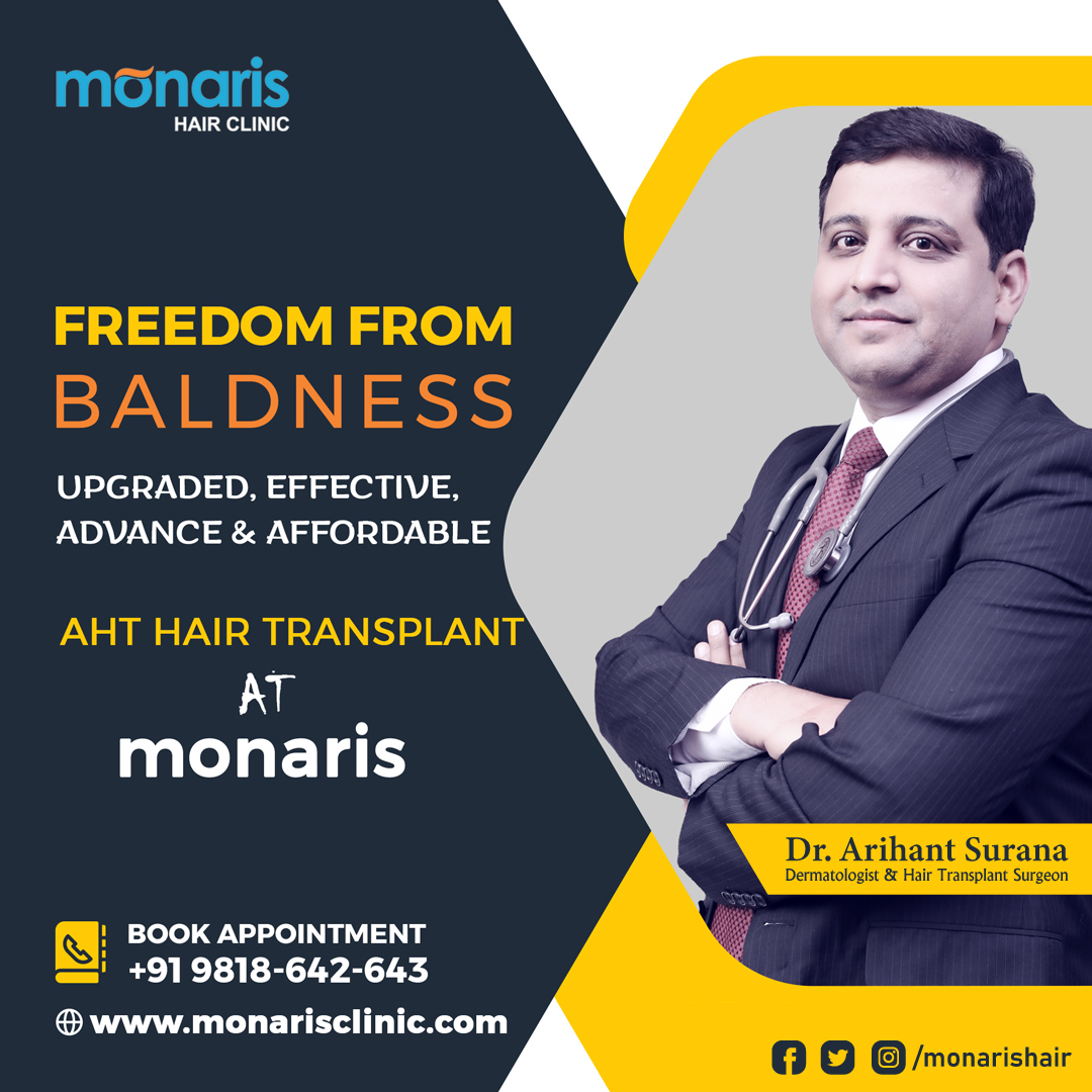 Hair Replacement In Delhi And Hair Transplant At Monaris 16667648648