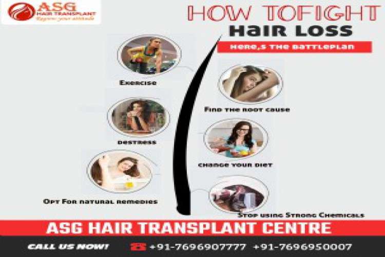 Hair Transplant In Ludhiana 4439203