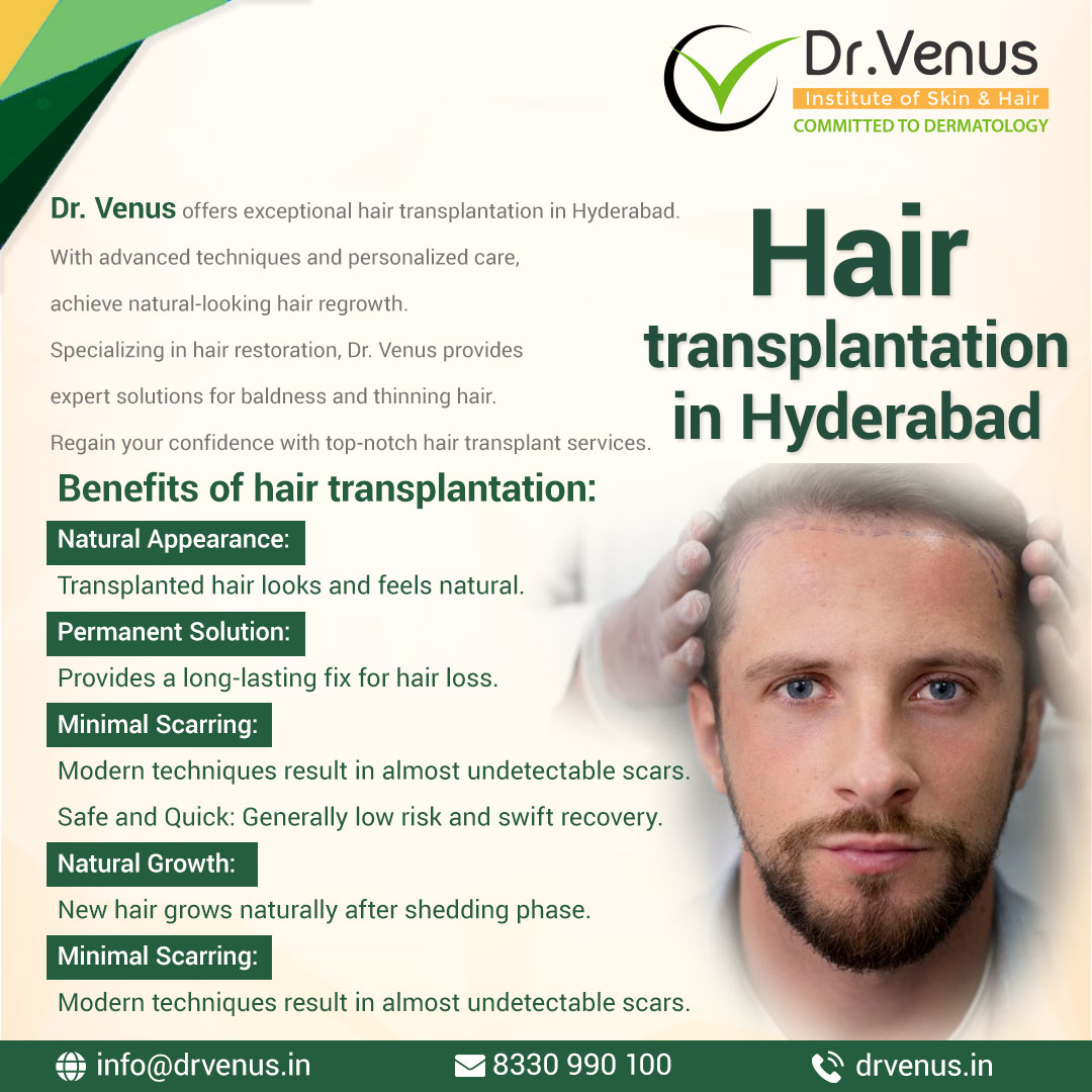 Hair Transplantation Hyderabad 16939830714