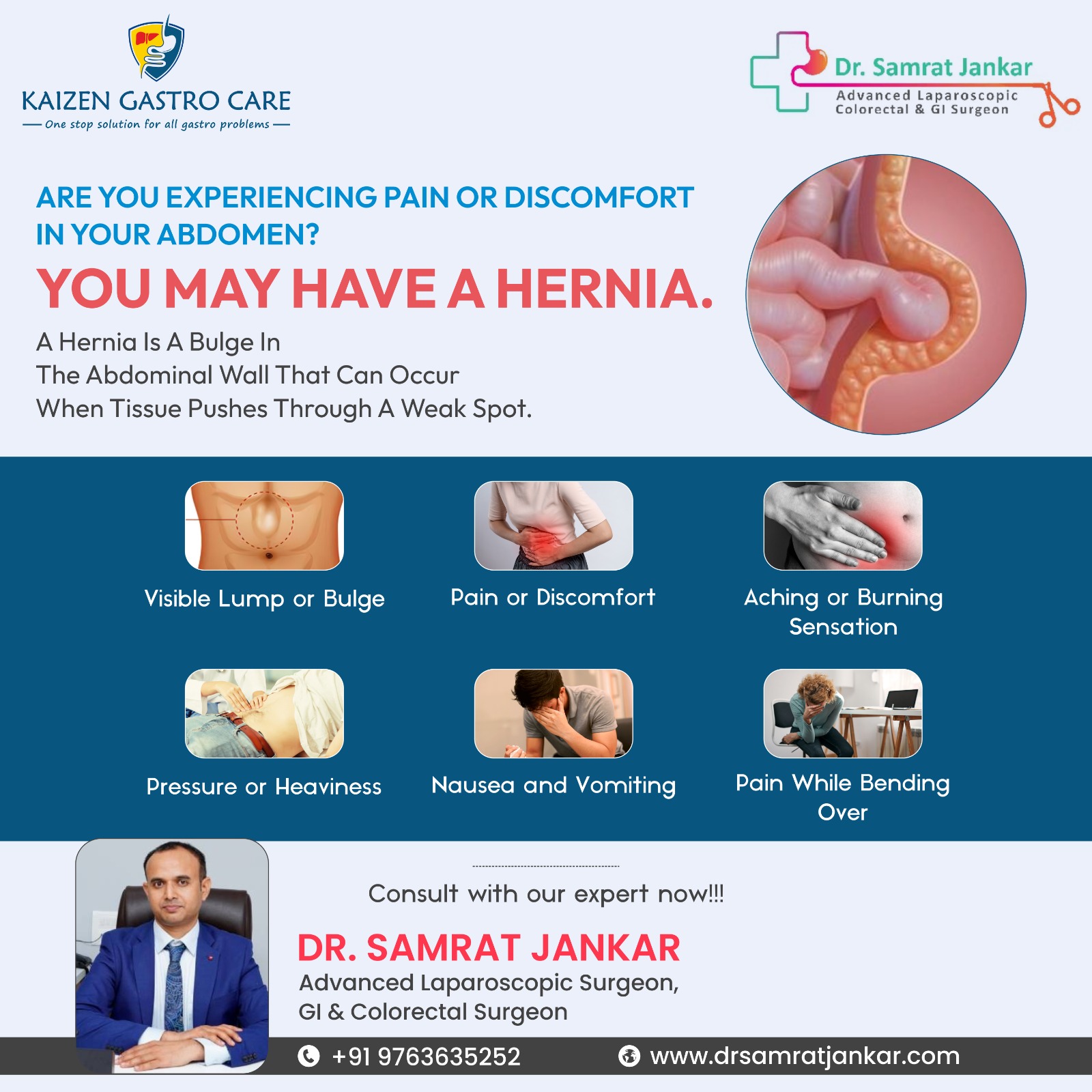 Hernia Specialist In Pune 17121403057