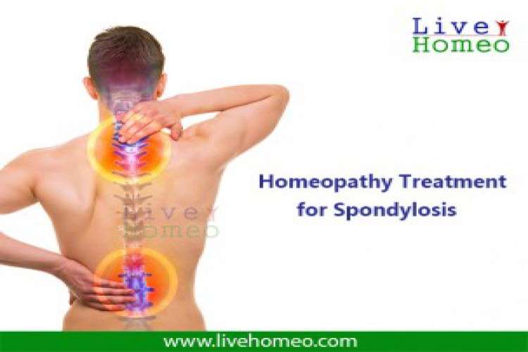 Homeopathy Treatment For Spondylosis 7849978