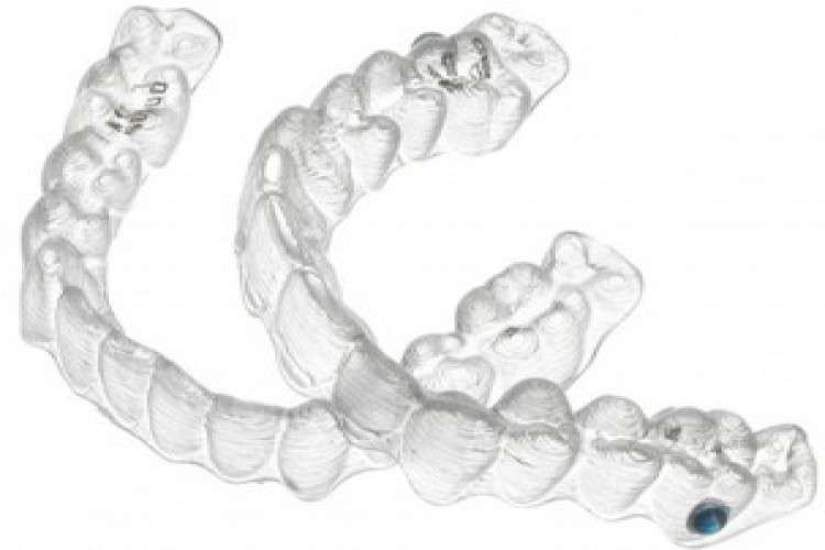 Invisalign Braces In Indore 3155711