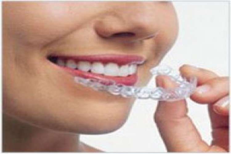 Invisible Braces By Dr Milind Darda Thirty Two Smiles Dental Clinic 9159080