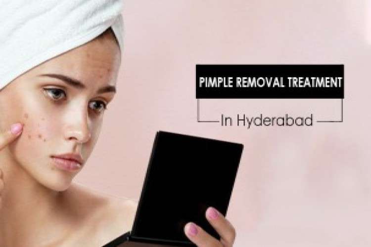 Pimple Removal Treatment 9553723