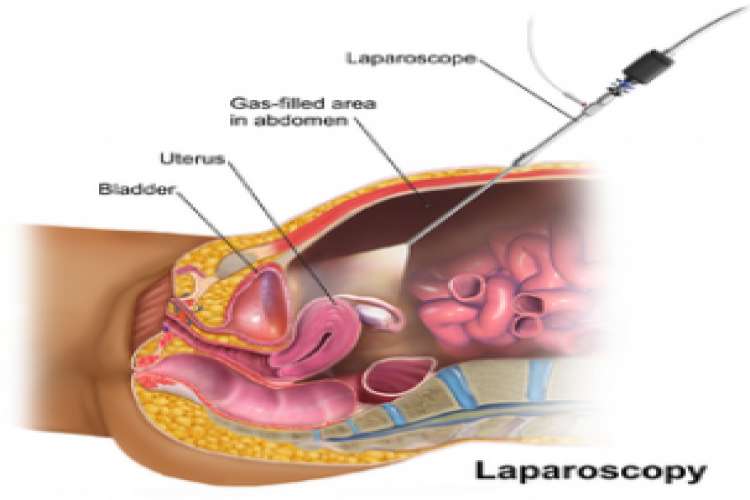 Top Laparoscopic Gynaecologist In Ahmedabad 836561