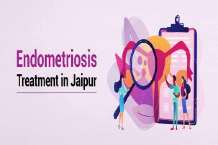 Visit Best Endometriosis Treatment In Jaipur 9271881